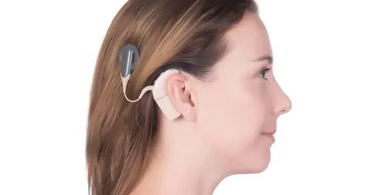 hành trình cấy ốc tai điện tử