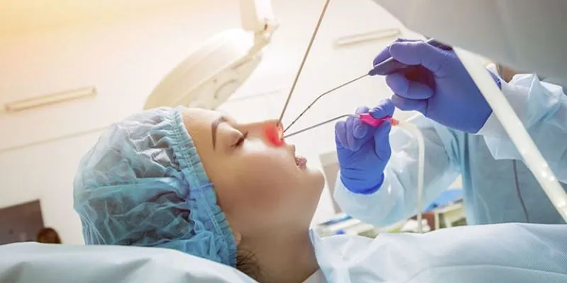 phẫu thuật viêm xoang mũi