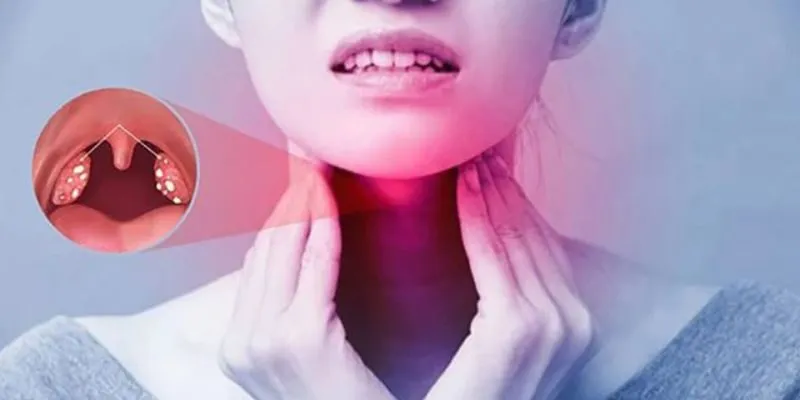 Viêm mũi họng cấp khi giao mùa