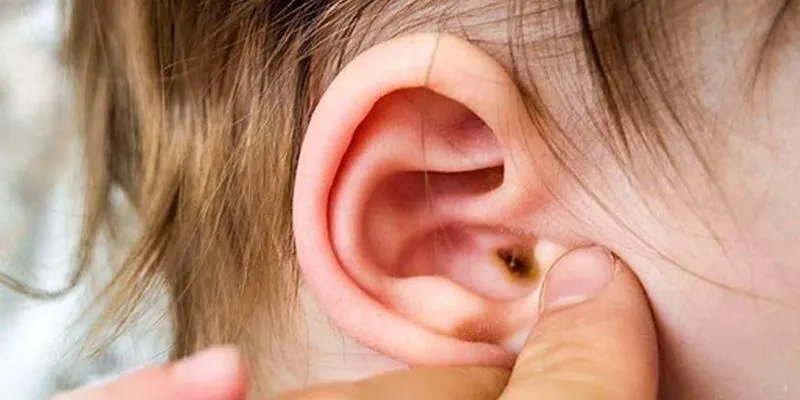 những vấn đề về tai thường gặp