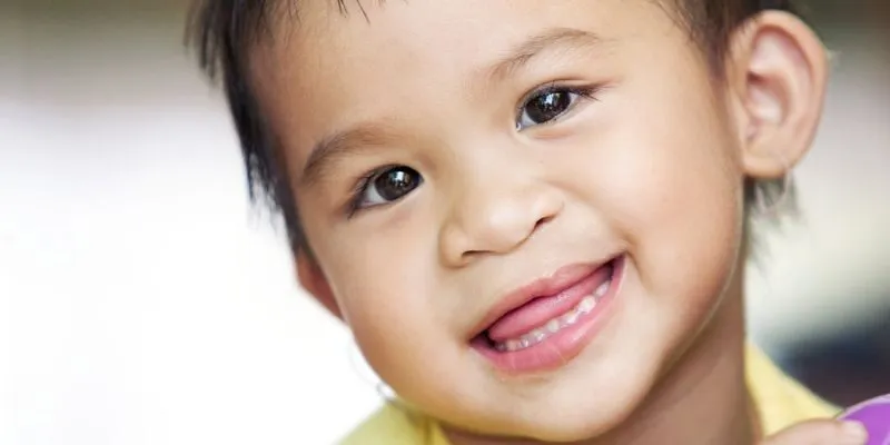 Phẫu Thuật Nụ Cười