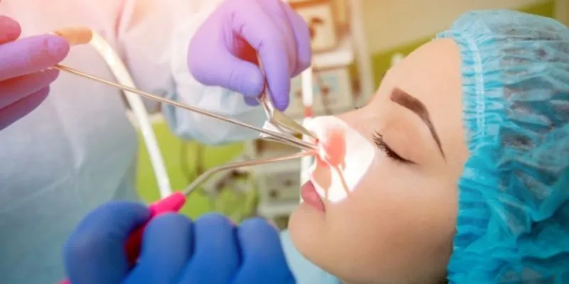 phẫu thuật viêm xoang mũi