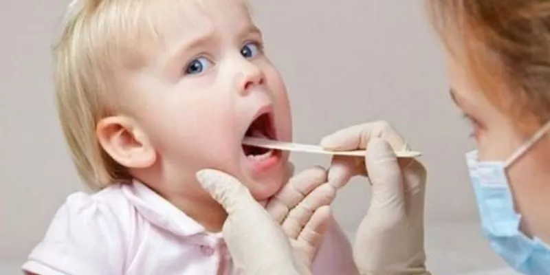 Dấu hiệu viêm VA ở trẻ