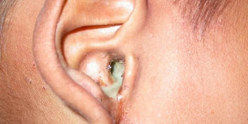 những vấn đề về tai thường gặp