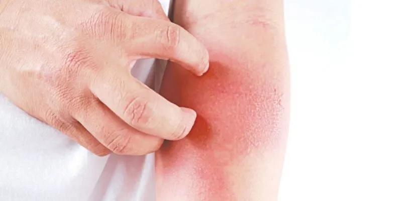 nguyên nhân gây bệnh Tai Mũi Họng