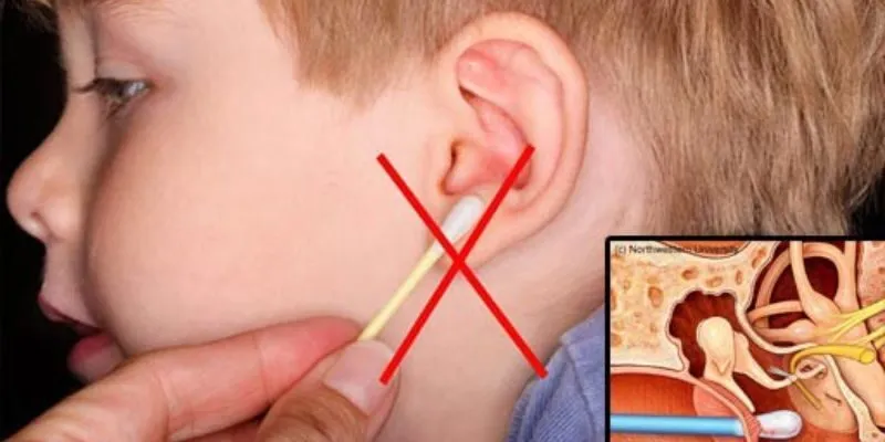 Nguyên nhân gây viêm ống tai ngoài ở trẻ