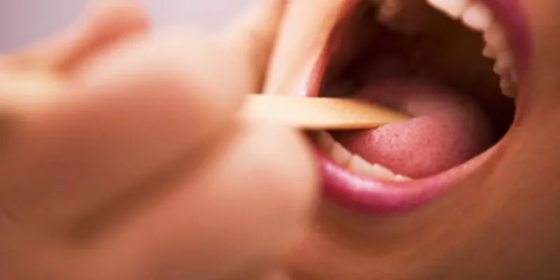 Ung thư Vòm họng