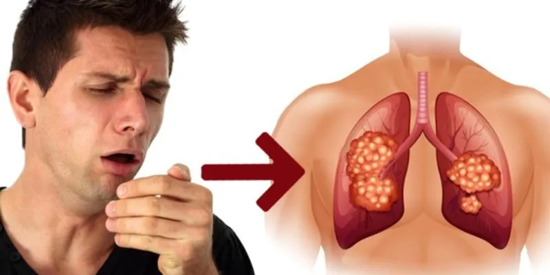 Ho khan trong thời gian dài