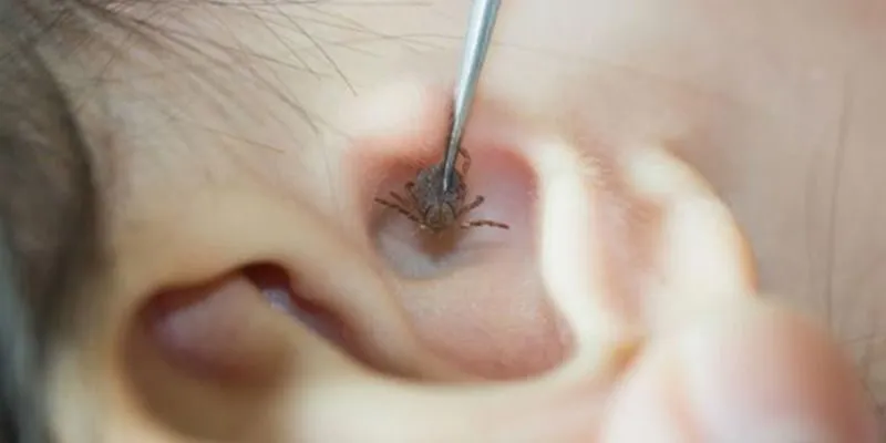 xử lý khi trẻ bị đau tai